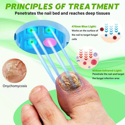 Nail Fungus Laser Device FDA Cleared 7-Minute Home Treatment for Toenail Fingernail Fungal Infections Portable Nail Care Device Fast-Acting Laser Nail Treatment