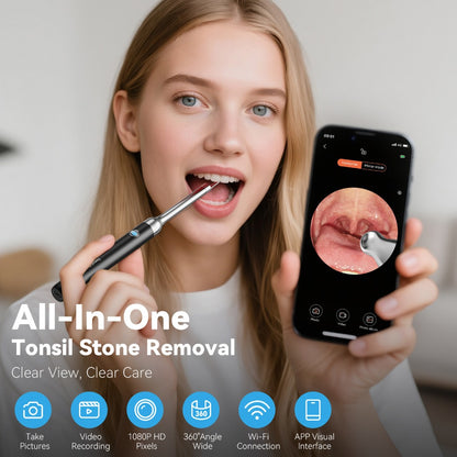 Tonsil Stone Remover with Camera 1080P HD Visual Oral Care Kit - 6 LED Lights, 5 Stainless Steel Tips, Wi-Fi App Control, USB-C Rechargeable Bad Breath Treatment Tool for iOS & Android