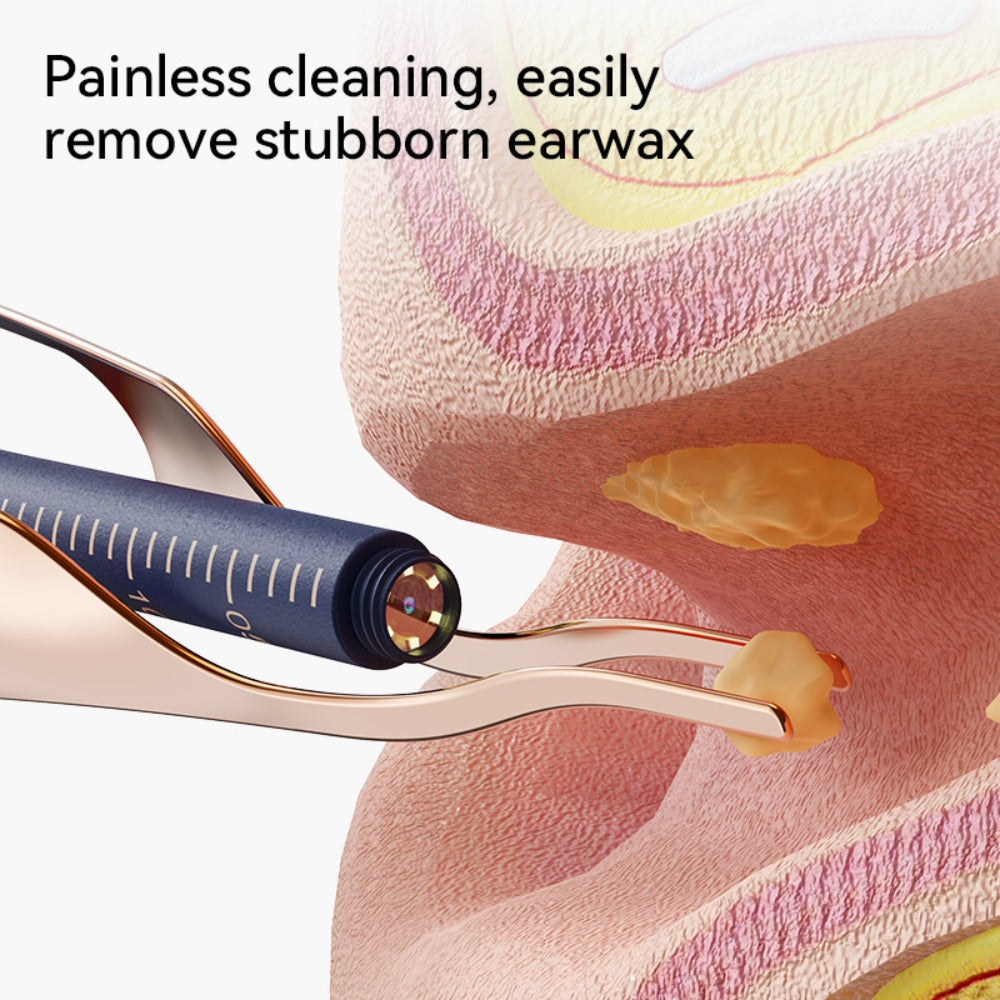 Earwax Removal Tool Set with Light & Camera – Rechargeable Ear Cleaning Kit for iOS & Android, Ear Wax Remover with Otoscope