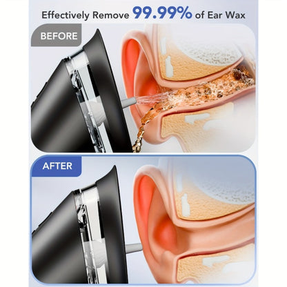 Earwax Removal Kit Pro with Visual Waste Tank – Interchangeable Nozzles, USB Rechargeable Ear Cleaner for Adults, Ear Scoop & Ear Washer Options