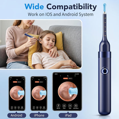 Earwax Removal Tool Set with Light & Camera – Rechargeable Ear Cleaning Kit for iOS & Android, Ear Wax Remover with Otoscope