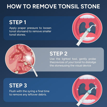 Visual Tonsil Stone Remover with 1080P HD Camera – 6 LED Lights, 5 Stainless Steel Heads, Bad Breath Prevention, iOS & Android Compatible, At-Home Tonsil Care Kit