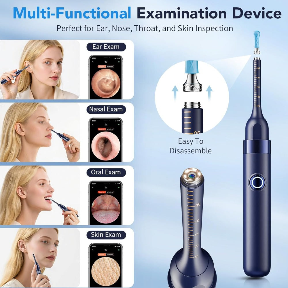 Earwax Removal Tool Set with Light & Camera – Rechargeable Ear Cleaning Kit for iOS & Android, Ear Wax Remover with Otoscope