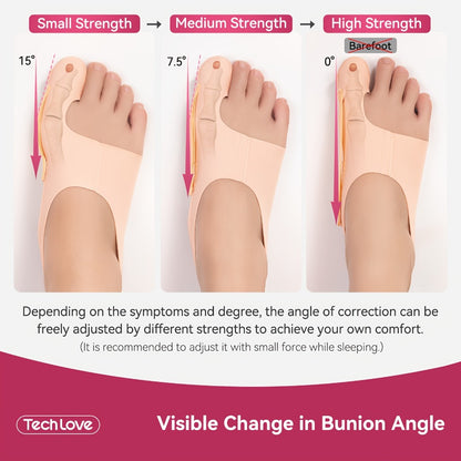Bunion Corrector Socks Big Toe Straightener 1 Pair Adjustable Breathable Day Night Sleeve In-Shoe Hallux Valgus Correction Medium Large