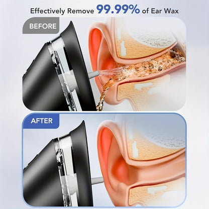 Electric Ear Cleaning System Professional Edition 3-Speed Hydraulic – Visual Waste Tank, Ear Dryer, USB Charging, Dry Dirty Storage, Safe Home Ear Wax Removal Kit Christmas Gift